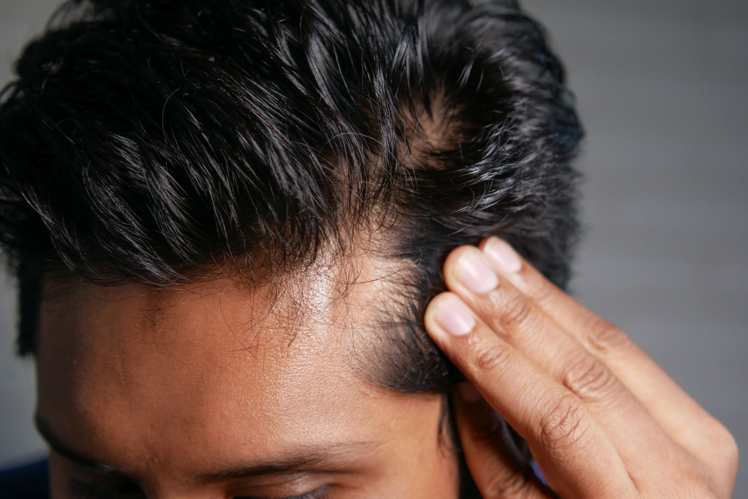 prp therapy in Leeds